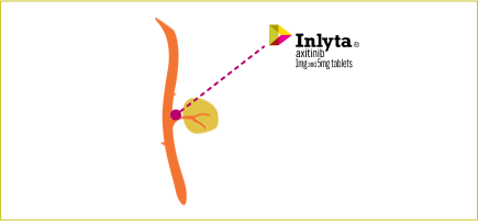 INLYTA® (axitinib) prevents new blood vessels from forming, it may help stop tumors from growing. See safety info
