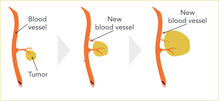 Cancer cells need a constant supply of oxygen and nutrients to spread. They get these from blood vessels